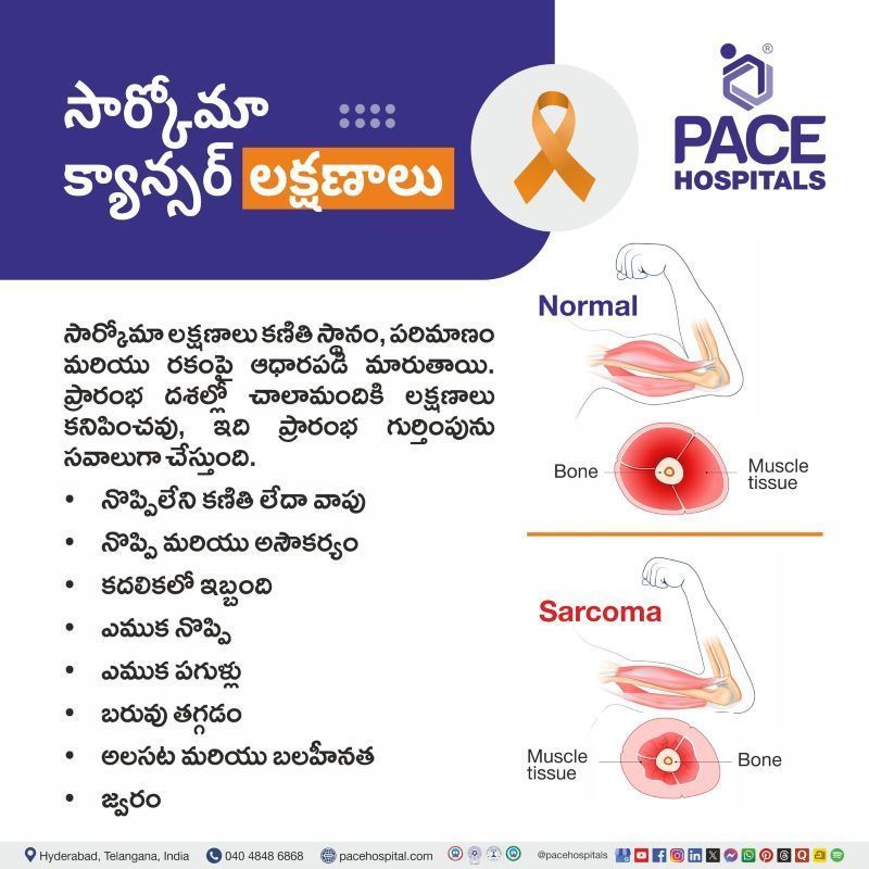 సార్కోమా క్యాన్సర్ లక్షణాలు | Sarcoma Cancer Symptoms in Telugu Sarcoma Symptoms in Telugu | సార్కోమా క్యాన్సర్ లక్షణాలు | Sarcoma Cancer Symptoms in Telugu