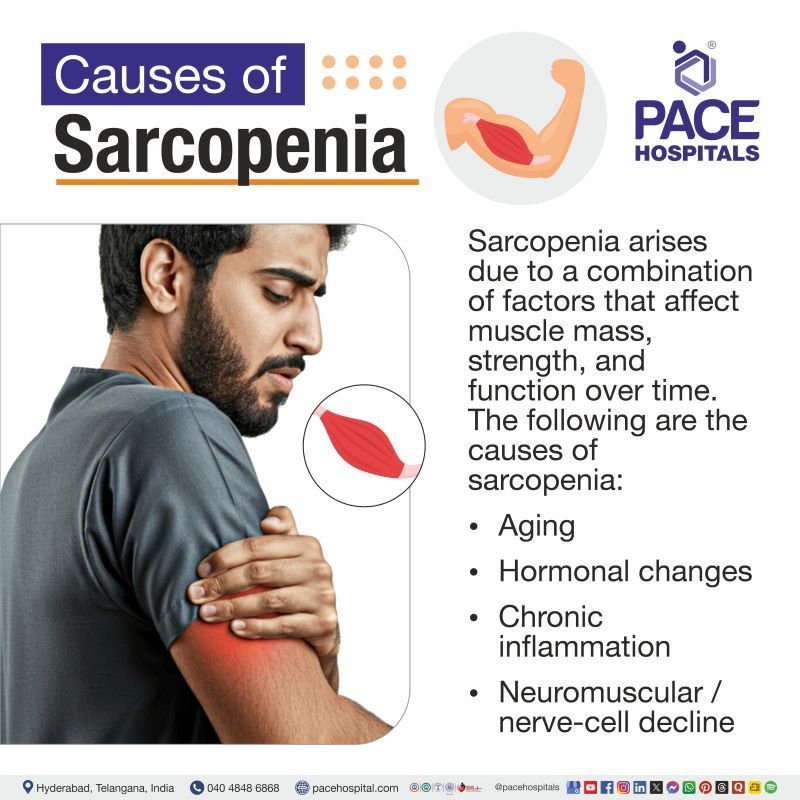Sarcopenia Causes Sarcopenia Causes | Causes of Sarcopenia