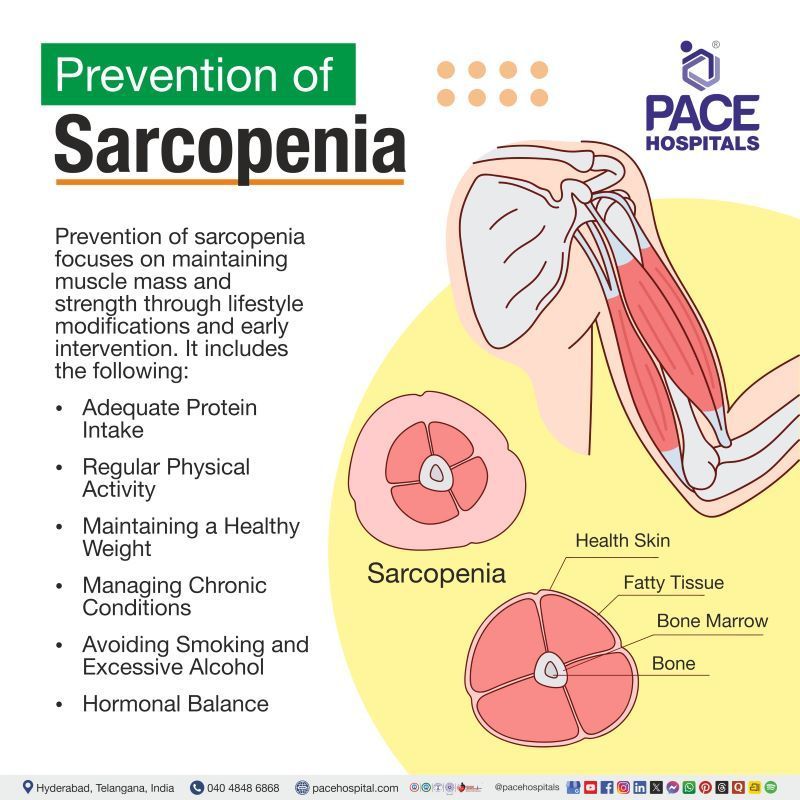 Sarcopenia Prevention Sarcopenia Prevention | Prevention of Sarcopenia