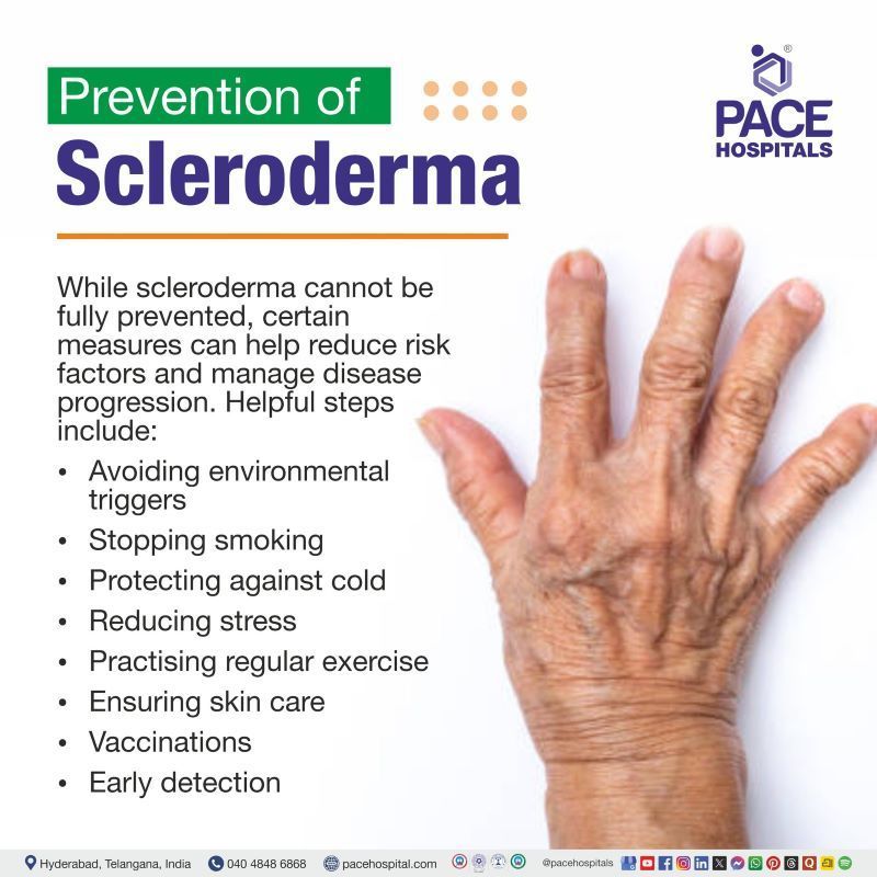Scleroderma Prevention Scleroderma Prevention | Prevention of Scleroderma