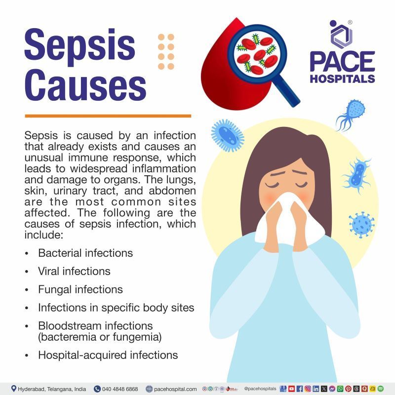 Sepsis Causes Sepsis Causes | What causes Sepsis | What is the most common cause of sepsis | How is sepsis caused