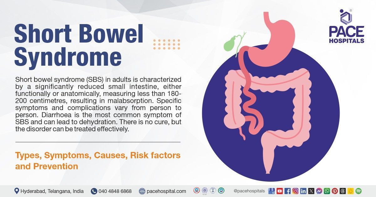 Short bowel syndrome (SBS) causes & diagnosis | Short bowel syndrome (SBS) treatment in India