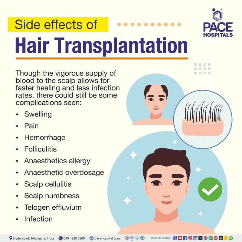 hair transplant side effects | long term side effects of hair transplant | hair transplant treatment side effects | side effects after hair transplant