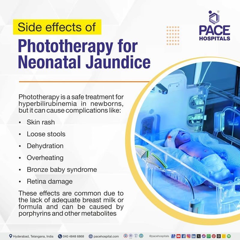 side effects of phototherapy in newborns | phototherapy for neonatal jaundice side effects | phototherapy side effects baby | phototherapy side effects in newborns