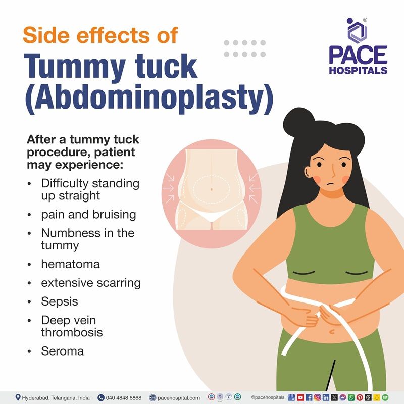 tummy tuck side effects | tummy tuck surgery side effects | abdominoplasty side effects | abdominoplasty surgery side effects | Side effects of tummy tuck surgery | Visual text revealing the Side effects of Tummy tuck surgery