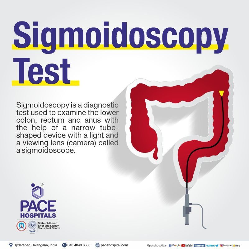 Sigmoidoscopy in Hyderabad | Sigmoidoscopy in India | Sigmoidoscopy procedure | Sigmoidoscopy meaning | Sigmoidoscopy test | Sigmoidoscopy cost