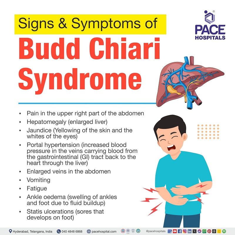 budd chiari symptoms | Signs and Symptoms of Budd-Chiari Syndrome | symptoms of budd chiari syndrome | Visual depicting the signs and symptoms of Budd-Chiari syndrome