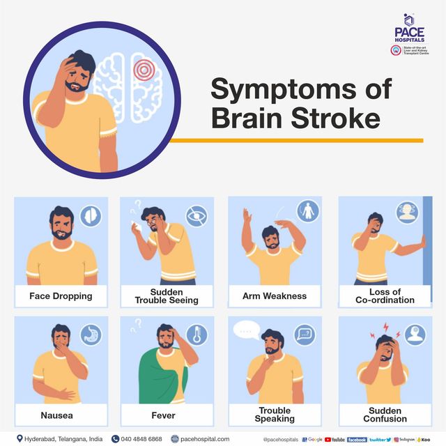 Stroke symptoms brain Stroke In