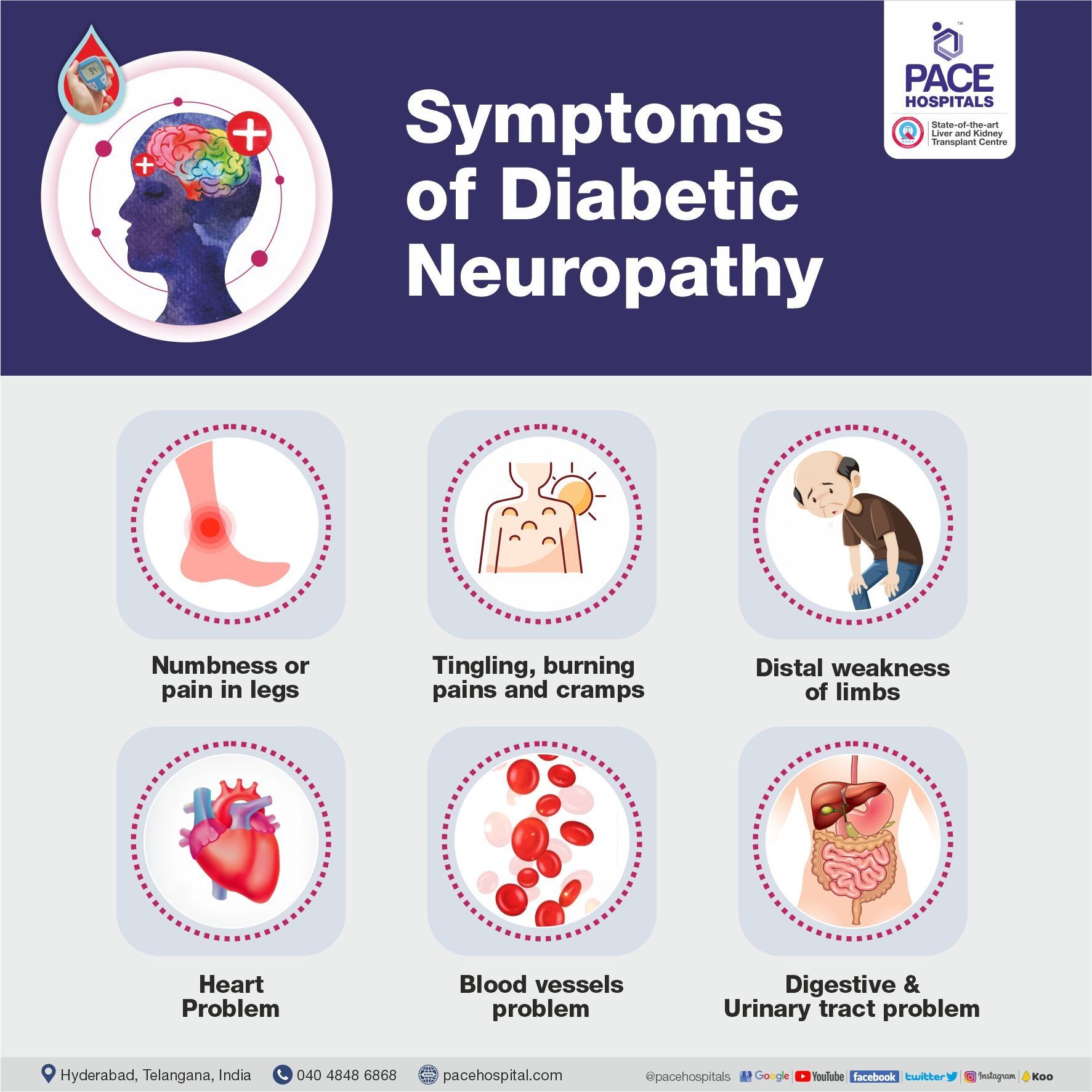 Signs and Symptoms of Diabetic Neuropathy