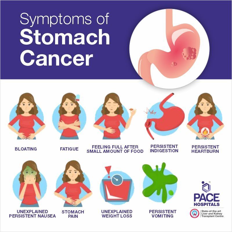 early symptoms of stomach cancer