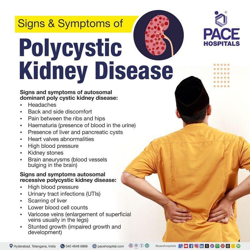 Polycystic kidney disease symptoms | polycystic kidney disease signs and symptoms | Symptoms of polycystic kidney disease | Visual depicting the signs and symptoms of polycystic kidney disease
