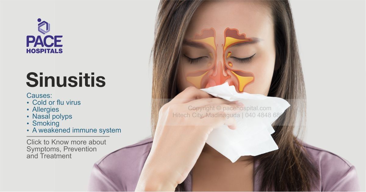 sinusitis-types-causes-symptoms-and-treatment