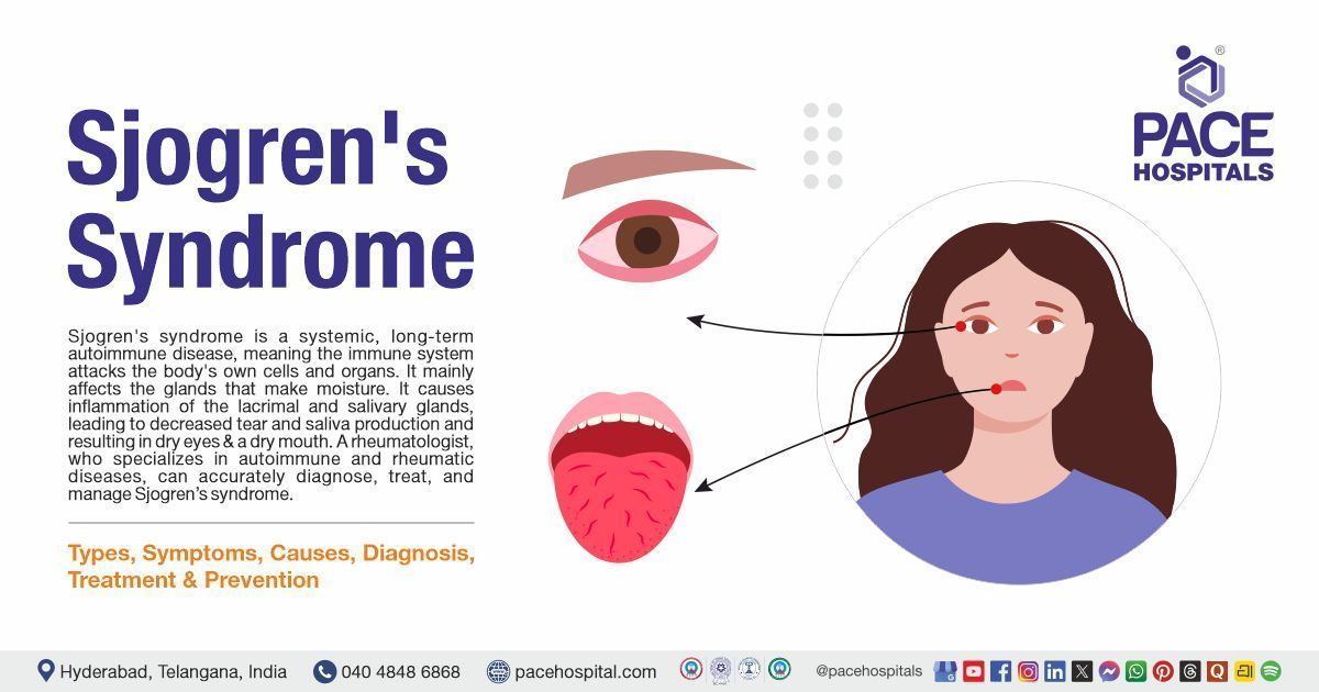 Sjogren’s Syndrome - Symptoms, Causes, Diagnosis & Treatment | What is Sjogren’s Syndrome
