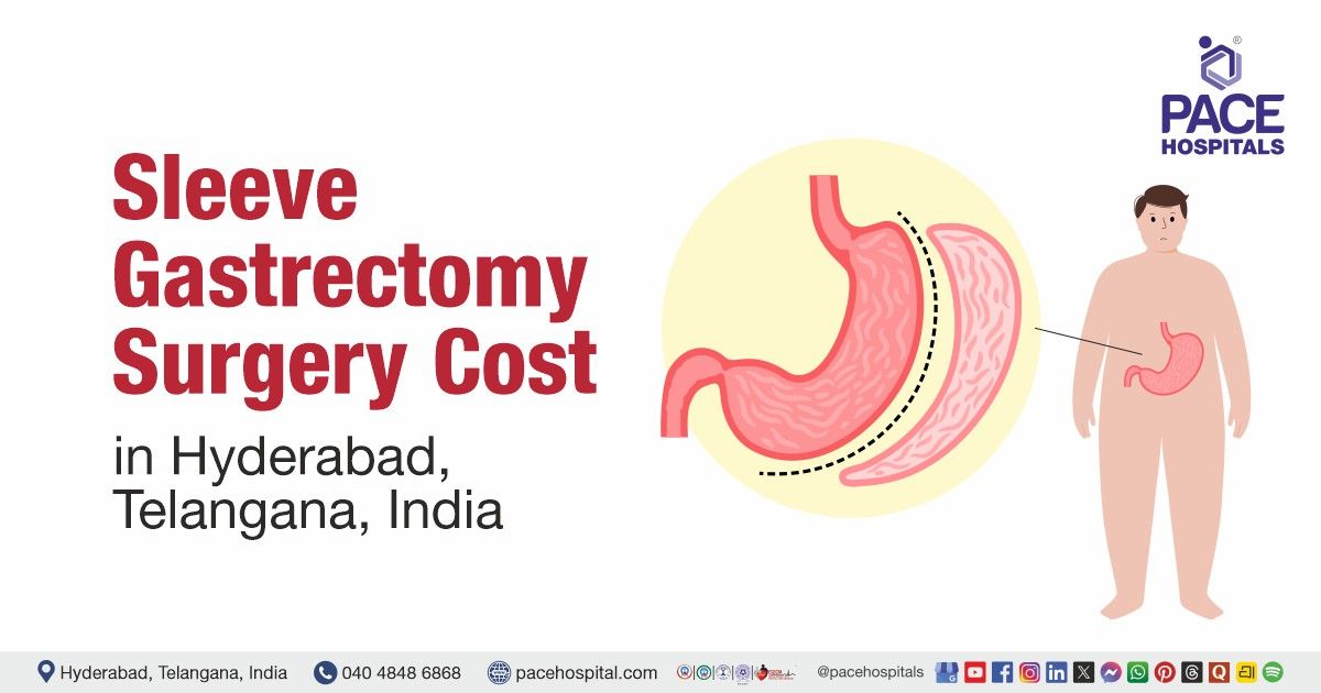 Sleeve Gastrectomy Surgery Cost in Hyderabad at PACE Hospitals, Cost of Sleeve Gastrectomy