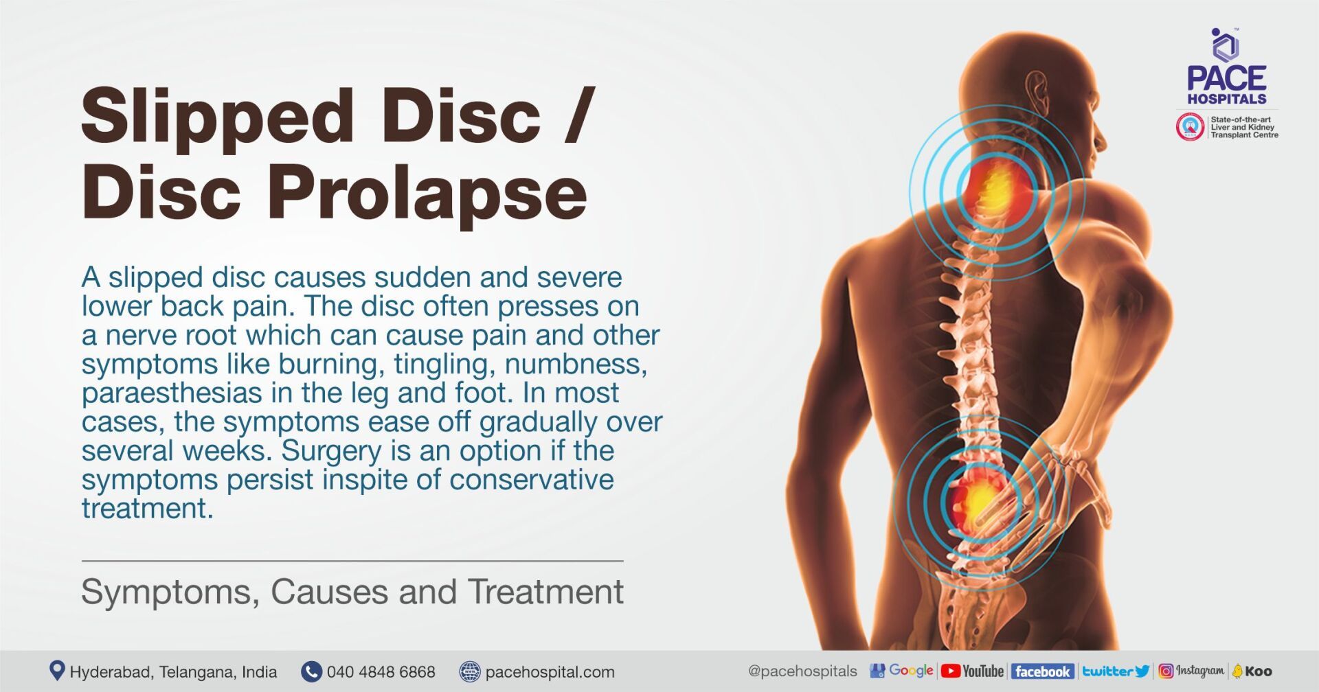 Slipped Disc Symptoms, Causes and Treatment | Disc Prolapse Treatment