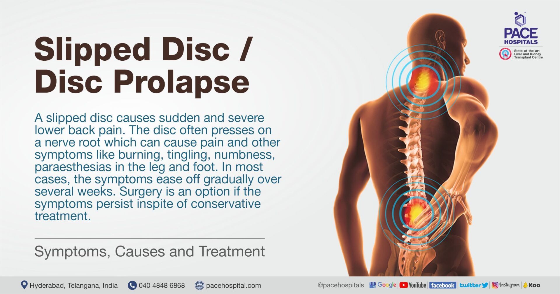 Slipped Disc Symptoms, Causes and Treatment