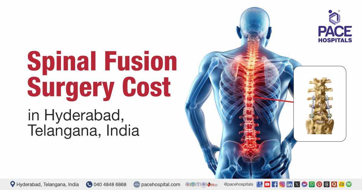 Spinal Fusion Surgery cost in Hyderabad at PACE Hospitals. Spinal Fusion Surgery cost estimate