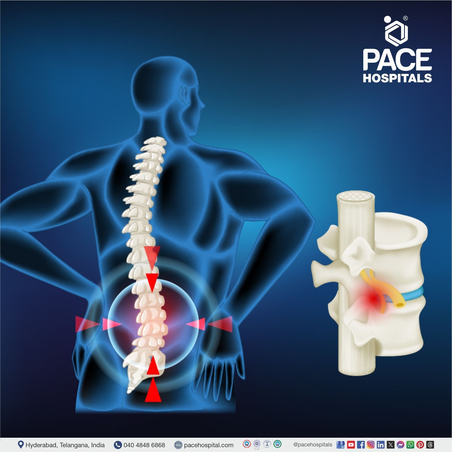 Spinal cord injury treatment in Hyderabad | spinal cord tumor treatment​ | spinal cord injury surgery