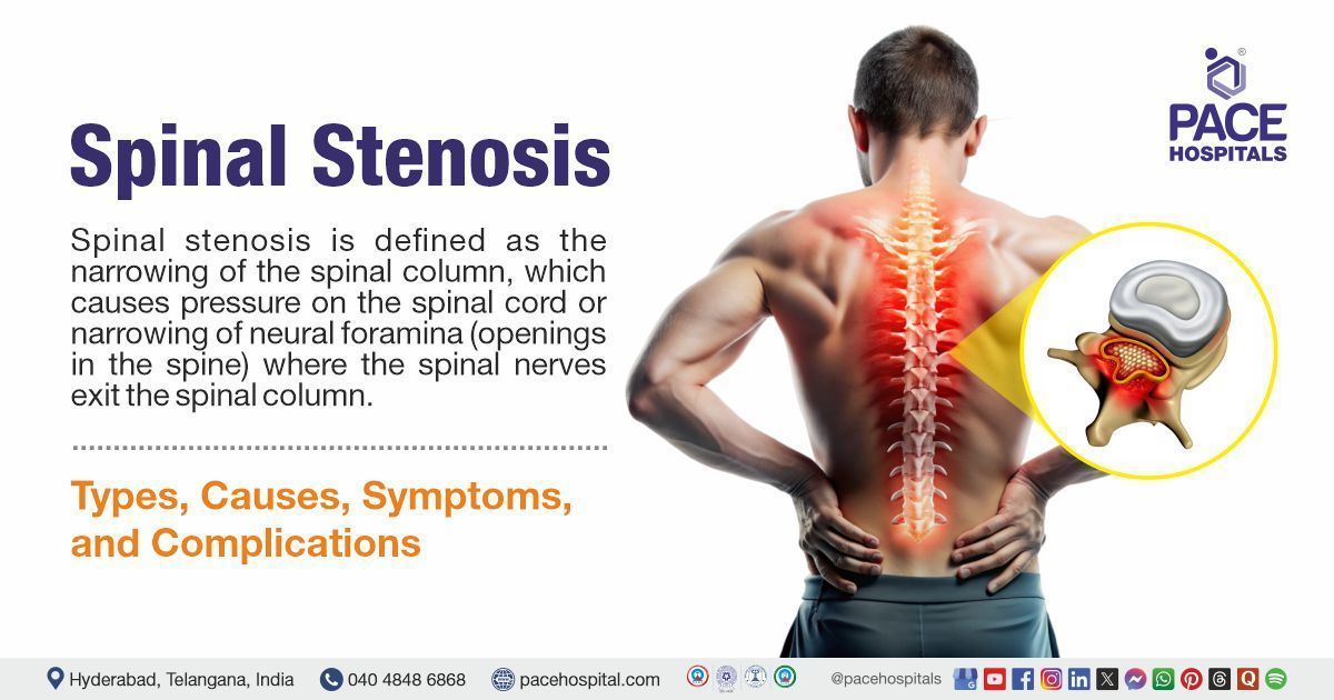 What is Spinal Stenosis? | Spinal Stenosis causes & symptoms | Spinal Stenosis treatment in India