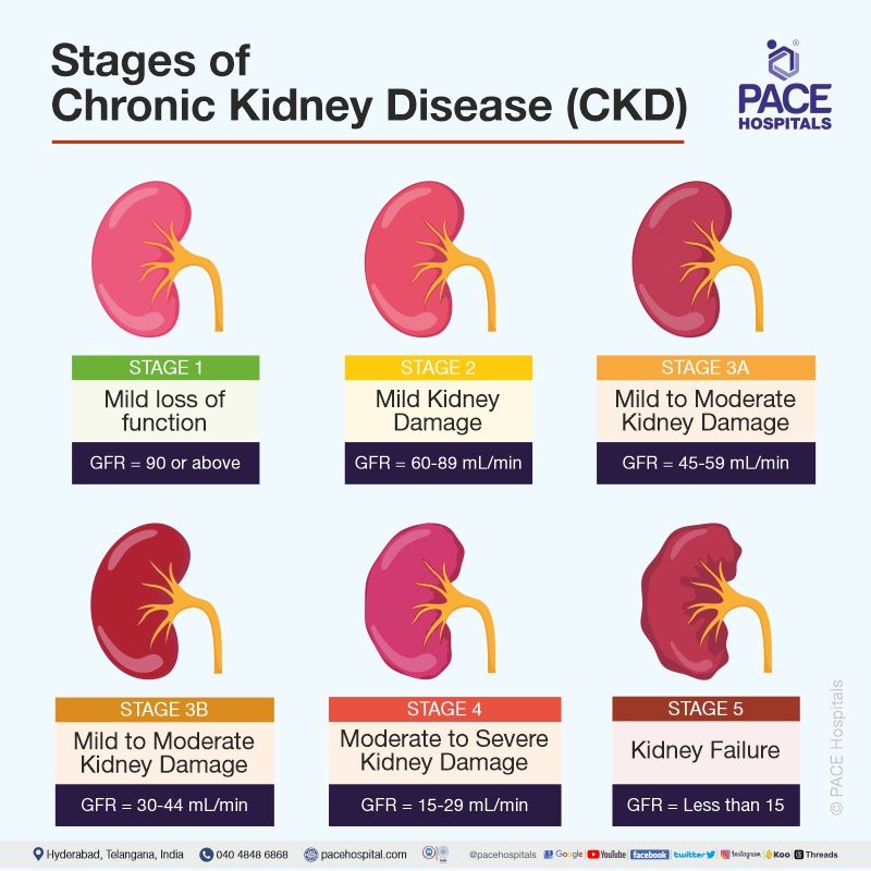 Chronic Kidney Disease Symptoms Stages Causes Risk Factors