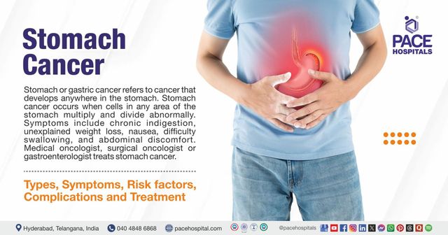 Stomach Cancer: Types, Symptoms, Causes, Treatment & Prevention