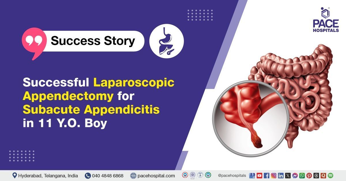 Case study of a patient diagnosed with subacute appendicitis, successfully treated at PACE Hospitals