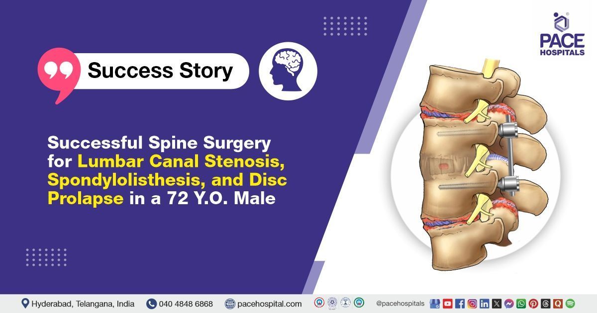 Multi-Level Degenerative Spine Disease treated in a 72 Y.O. male at PACE Hospitals, Hyderabad, India