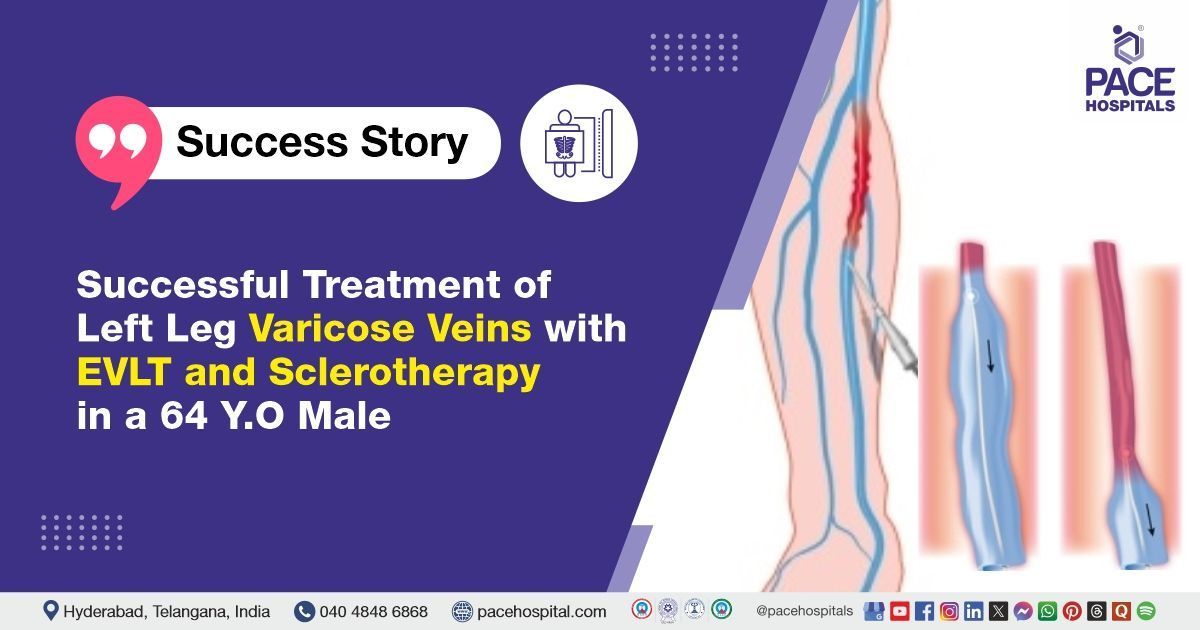 Case study minimally invasive varicose vein treatment in a 64-year-old male at PACE Hospitals
