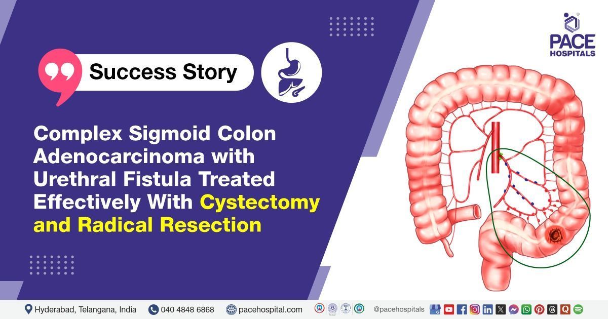 Case study of a 69 YO female with sigmoid colon cancer & urethral fistula treated at PACE Hospitals