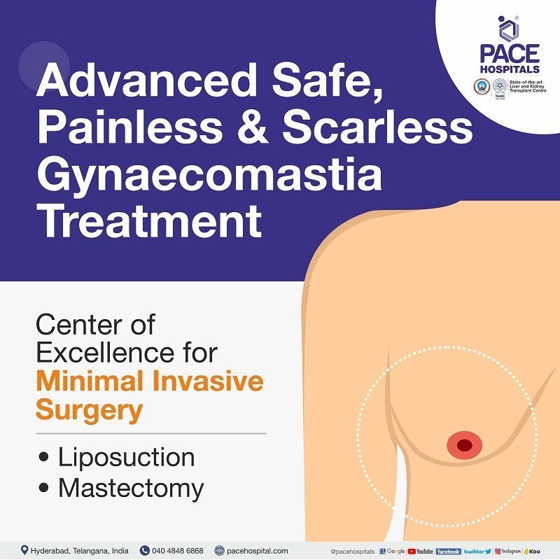 Gynecomastia surgery in Hyderabad | Gynaecomastia treatment in Hyderabad