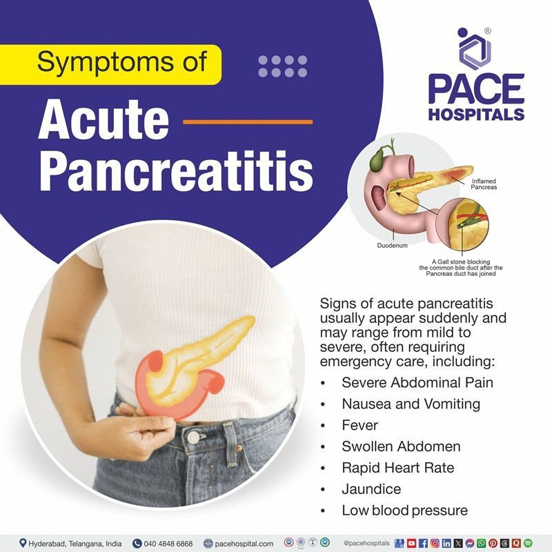 Acute pancreatitis signs and symptoms​ | Visual showing the symptoms of acute pancreatitis