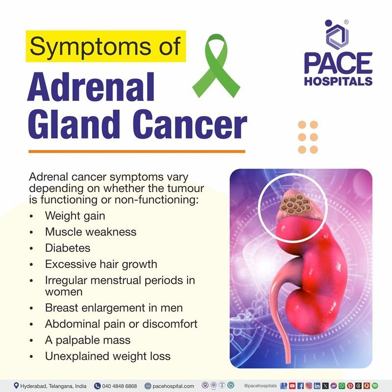 adrenal cancer symptoms​ | Visual depicting the symptoms of adrenal gland cancer