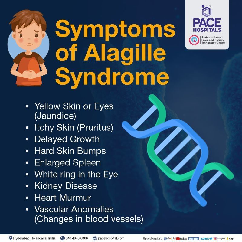 alagille syndrome symptoms