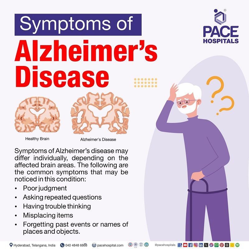 Alzheimer's disease symptoms | signs and symptoms of Alzheimer's disease | early symptoms of Alzheimer's disease | Visual depicting the symptoms of Alzheimer's Disease
