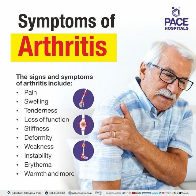 Arthritis, Causes, symptoms, treatment