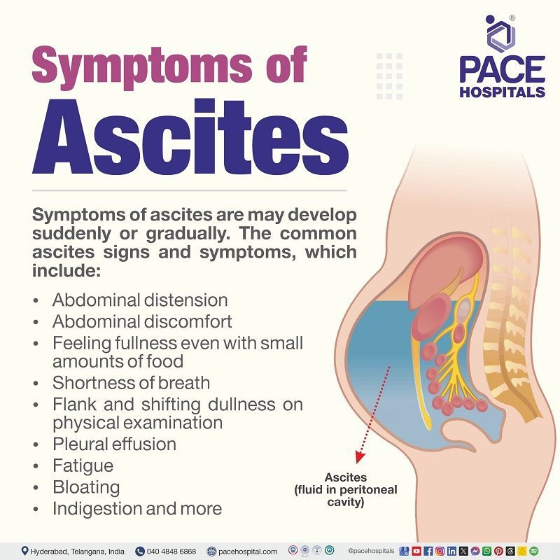 Symptoms of Ascites |  Ascites Symptoms | what are the symptoms of Ascites | ascites signs and symptoms |  ascites symptoms female | Visual underlining the symptoms of Ascites
