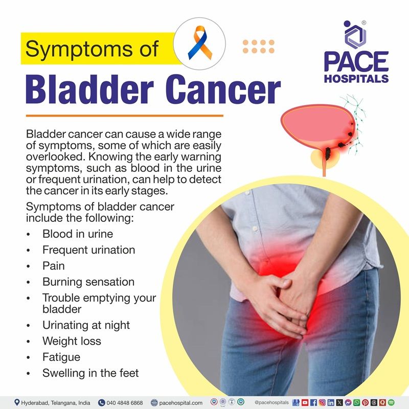 Bladder cancer symptoms | Visual showing the symptoms of bladder cancer