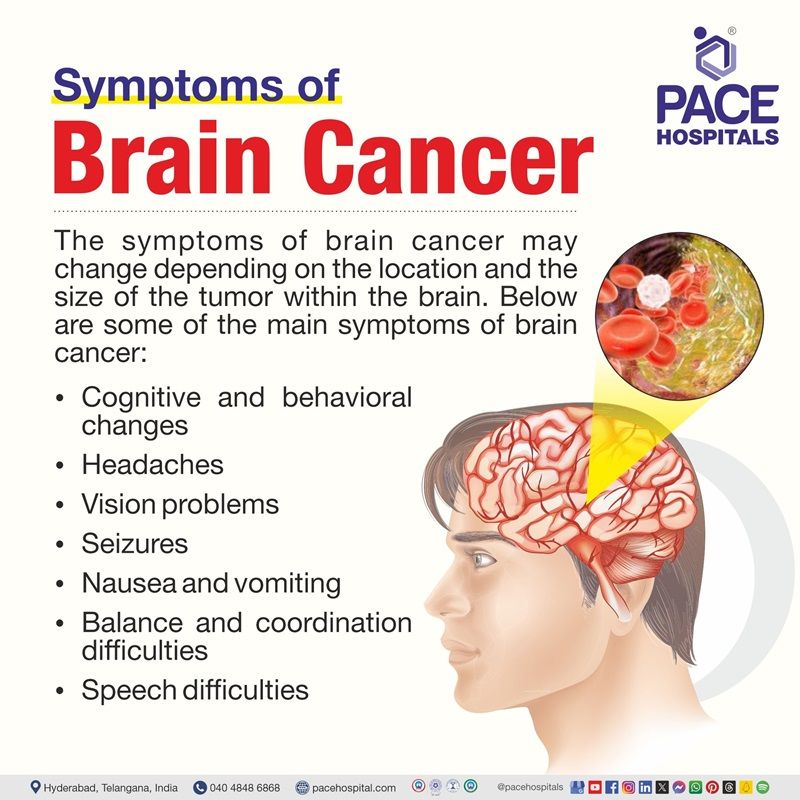 symptoms of brain cancer in females | what are the symptoms of brain cancer | brain cancer last stage symptoms | brain cancer early symptoms | Visual showing the symptoms of Brain cancer