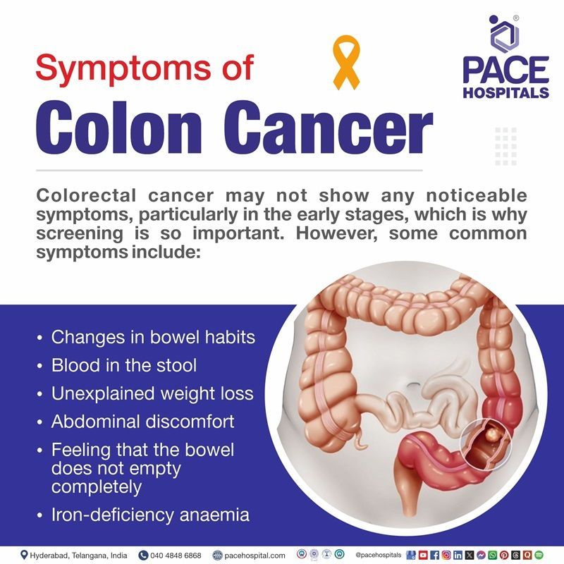 Colon cancer symptoms | Image showing the symptoms of colon cancer (colorectal cancer)