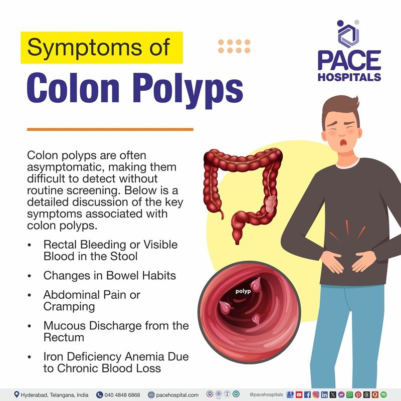 Image showing the signs and symptoms of colon polyps