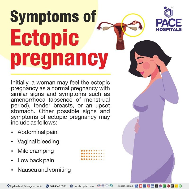 Ectopic pregnancy symptoms | signs & symptoms of ectopic pregnancy |   symptoms of ectopic pregnancy | Early symptoms of ectopic pregnancy | ectopic pregnancy signs and symptoms