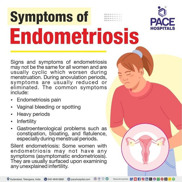 Symptoms prevalent according to location of endometriosis implants