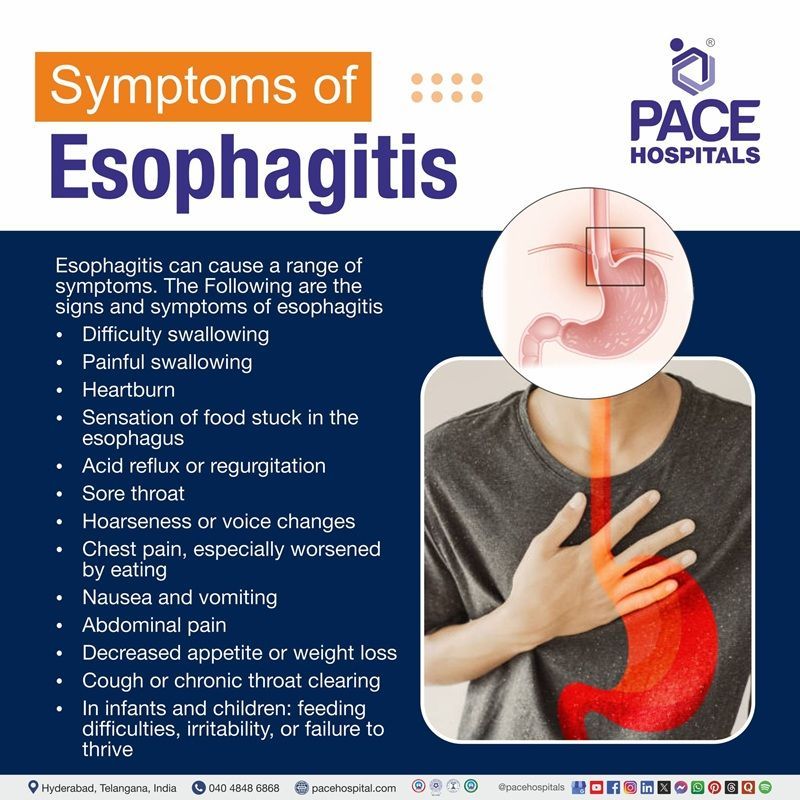 Esophagitis Symptoms esophagitis symptoms | symptoms of esophagitis | early signs of esophagitis | mild esophagitis symptoms vs severe esophagitis symptoms