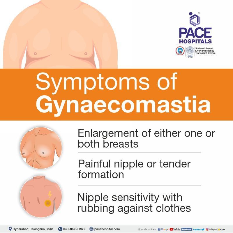 gynecomastia symptoms | gynaecomastia