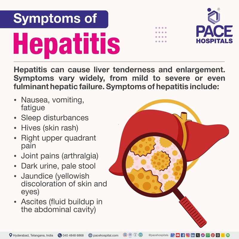 Hepatitis b Symptoms | Hepatitis A Symptoms | Hepatitis C Symptoms | hepatitis symptoms | Visual depicting the symptoms of Hepatitis 