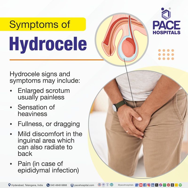 hydrocele symptoms​ | hydrocele signs and symptoms​ | testicular hydrocele symptoms​ | hydrocele causes symptoms and treatment​