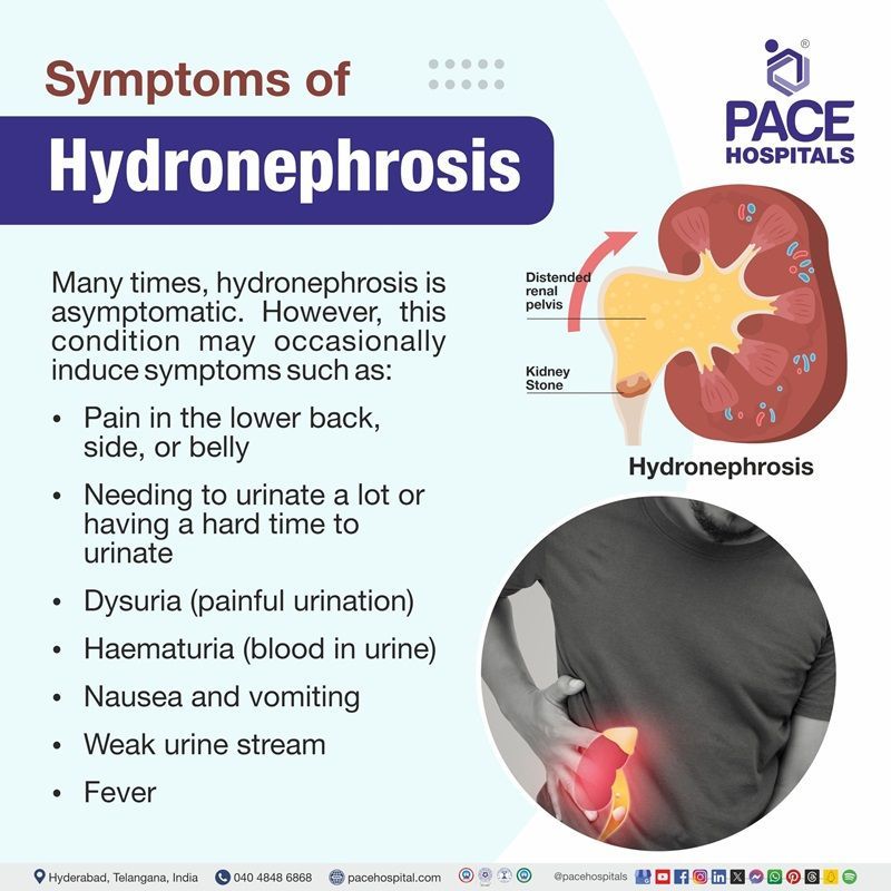 hydronephrosis signs and symptoms | hydronephrosis symptoms | hydronephrosis symptoms in adults, females & babies | hydronephrosis in infants symptoms