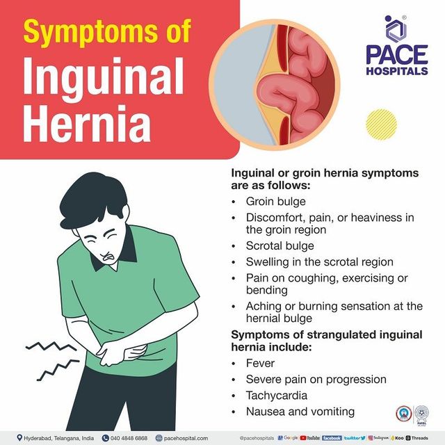 Inguinal Hernia - Signs and Symptoms, Types, Causes, Risk Factors