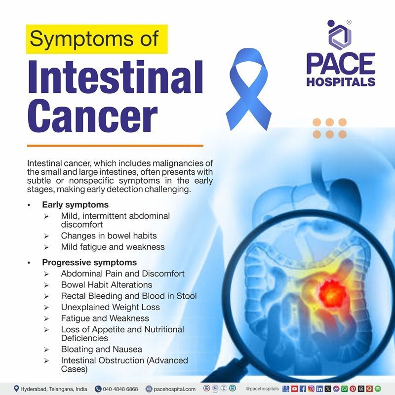 Intestinal Cancer Symptoms | visual showing the small and large intestine cancer symptoms