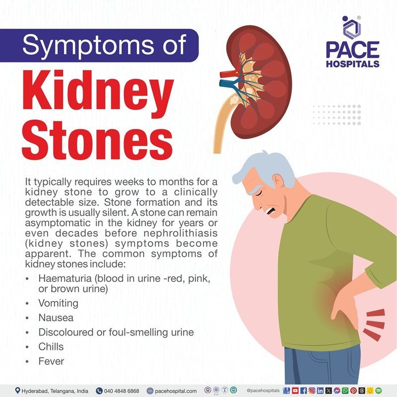 kidney stone symptoms | kidney stone symptoms in women | kidney stones symptoms female | kidney stone symptoms in men | Visual outlining the symptoms of Kidney stones
